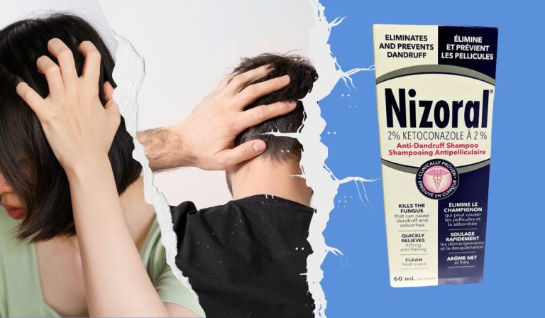 Nizoral 2% Anti-Dandruff Shampoo - Cloud Pharmacy toronto