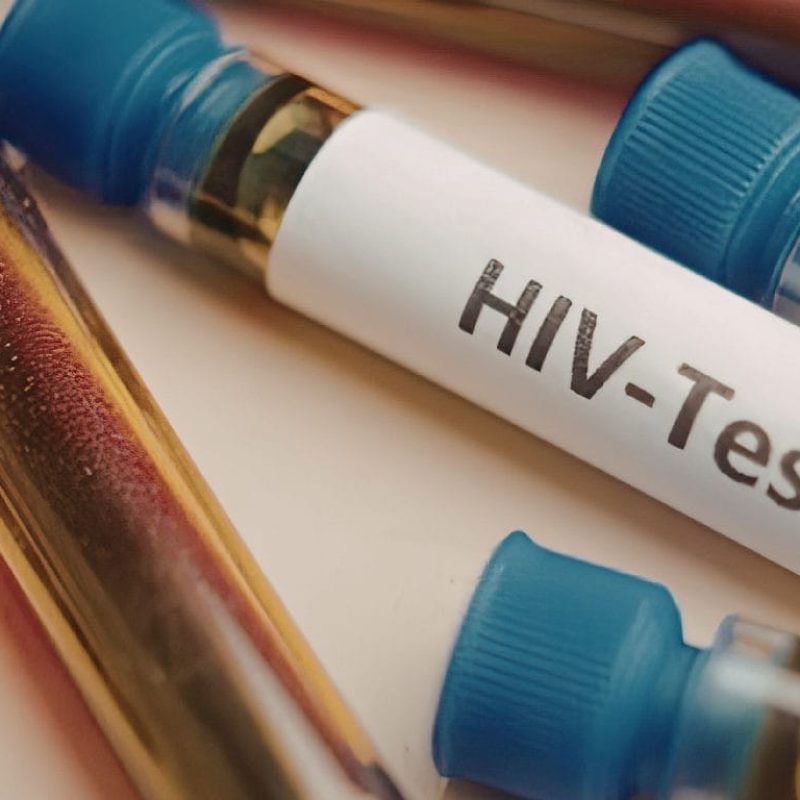 hiv pharmacy services toronto